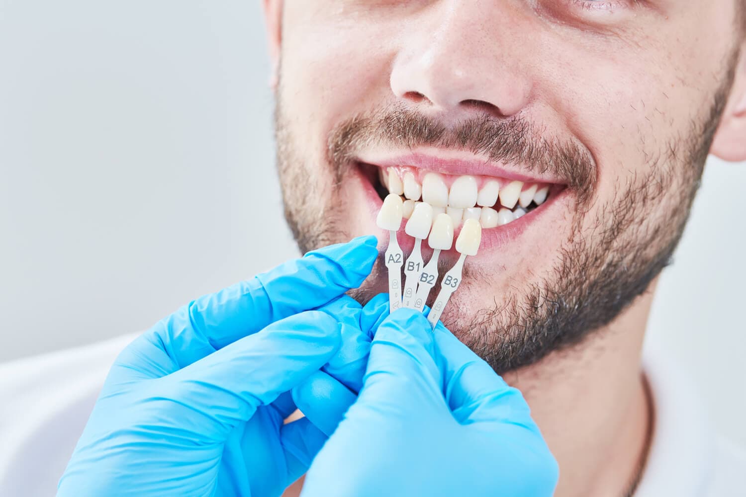 Estética dental Ferrol