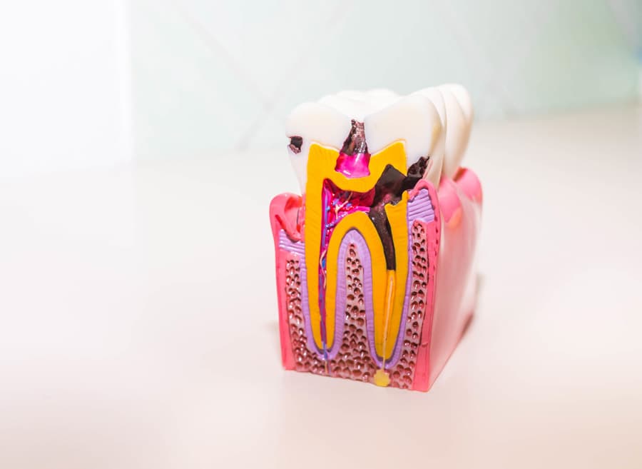 Preguntas frecuentes sobre nuestras endodoncias